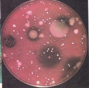 Método científico. Bacterias creciendo en una caja de petri