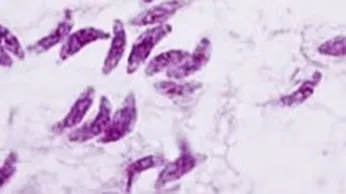 Parásito causante de la toxoplasmosis